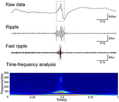 Automated Detection of High-Frequency Oscillations in Epilepsy Based on a Convolutional Neural Network